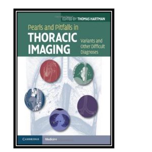 کتاب Pearls and Pitfalls in Thoracic Imaging: Variants and Other Difficult Diagnoses اثر Thomas Hartman انتشارات مؤلفین طلایی